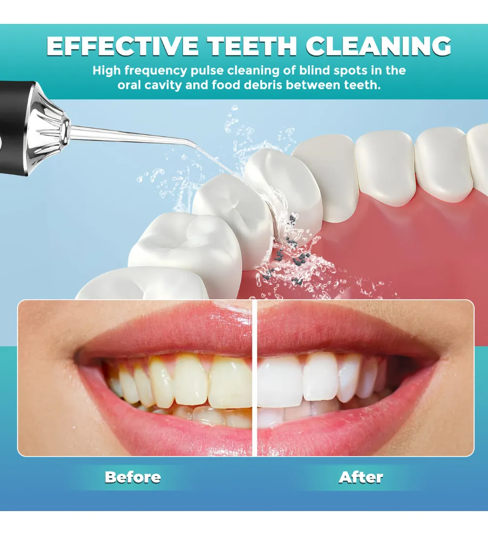 💦 Irrigador Oral Portátil Waterpulse